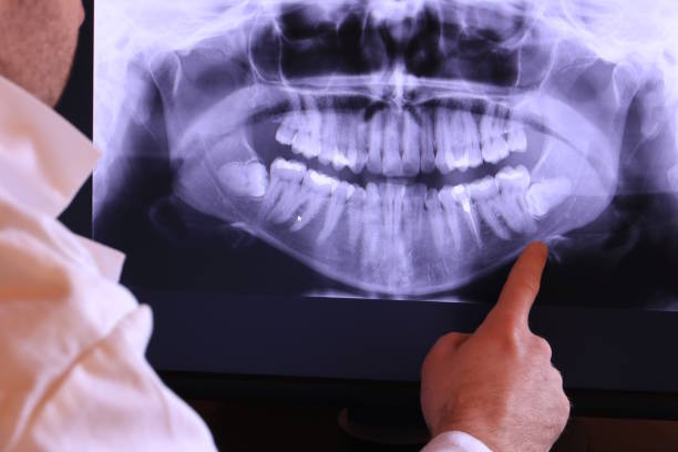 Best Dentist for Tooth Abscess  in Lake Stickney, WA